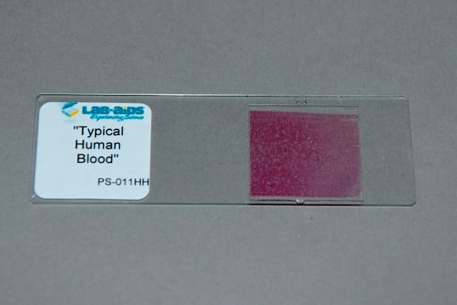 Human Blood, Typical, Prepared Slide