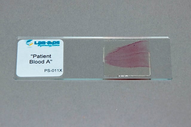 Patient A Blood, Prepared Slide